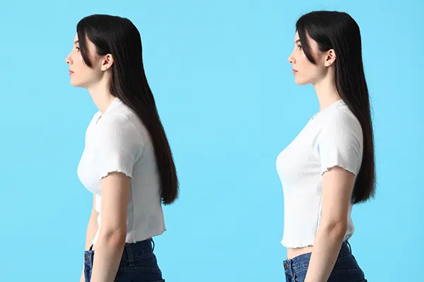 不良姿勢のイメージ